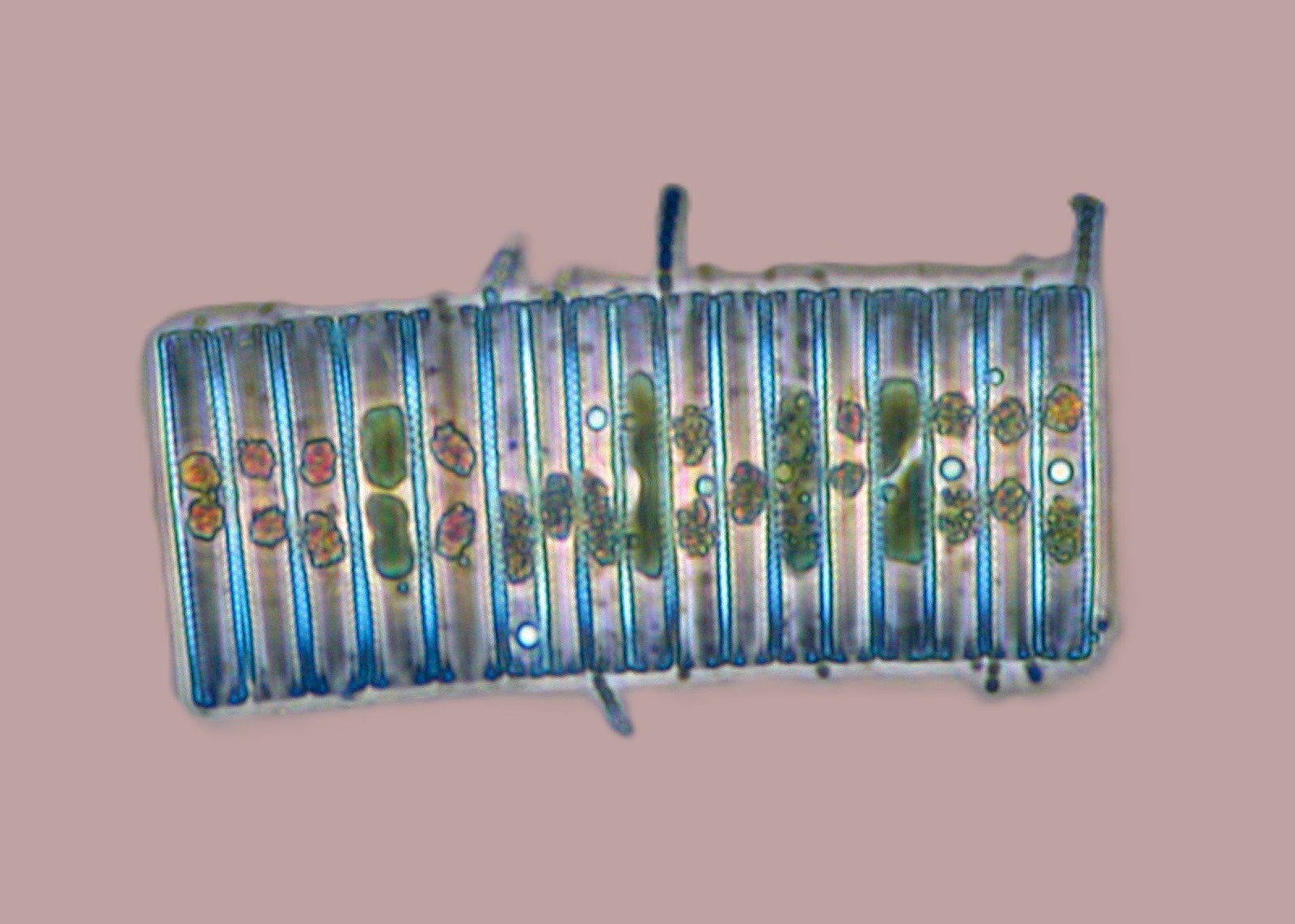 Microalga (diatomeas)